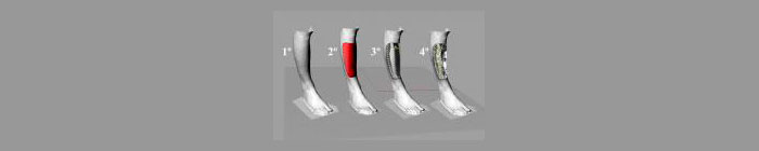 proceso_espinilleras